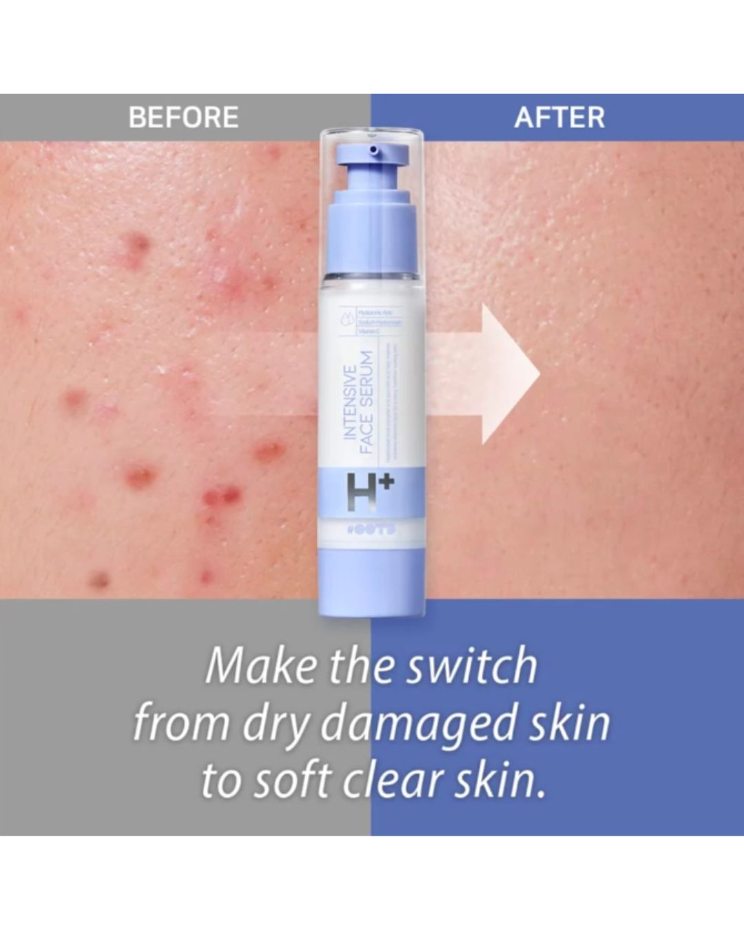 Intensive Moisture Face Serum A.M